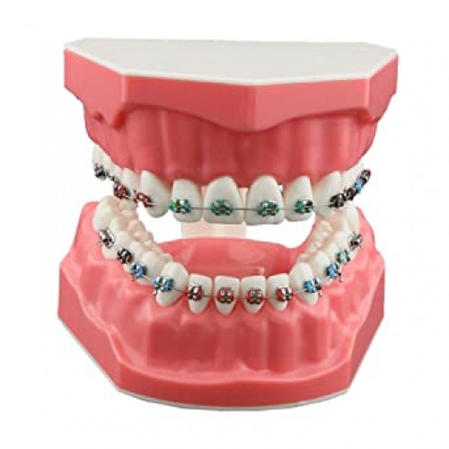 Dental Orthodontic Jaw Model