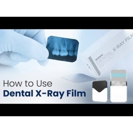 Waldent Dental X-Ray Film IOPA (E Speed / F Speed)