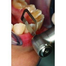 Denext Orthodontic Inter-..