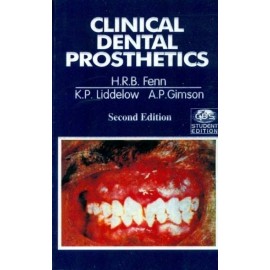 Clinical Dental Prosthetics 2nd Edition 