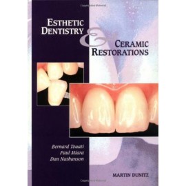 Esthetic Dentistry and Ceramic Restoration 1st Edition
