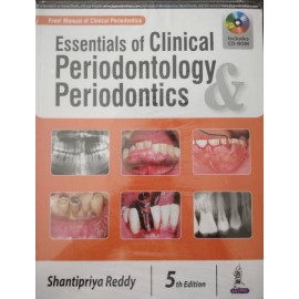 Essentials of Clinical Periodontology & Periodontics : Periodontics 